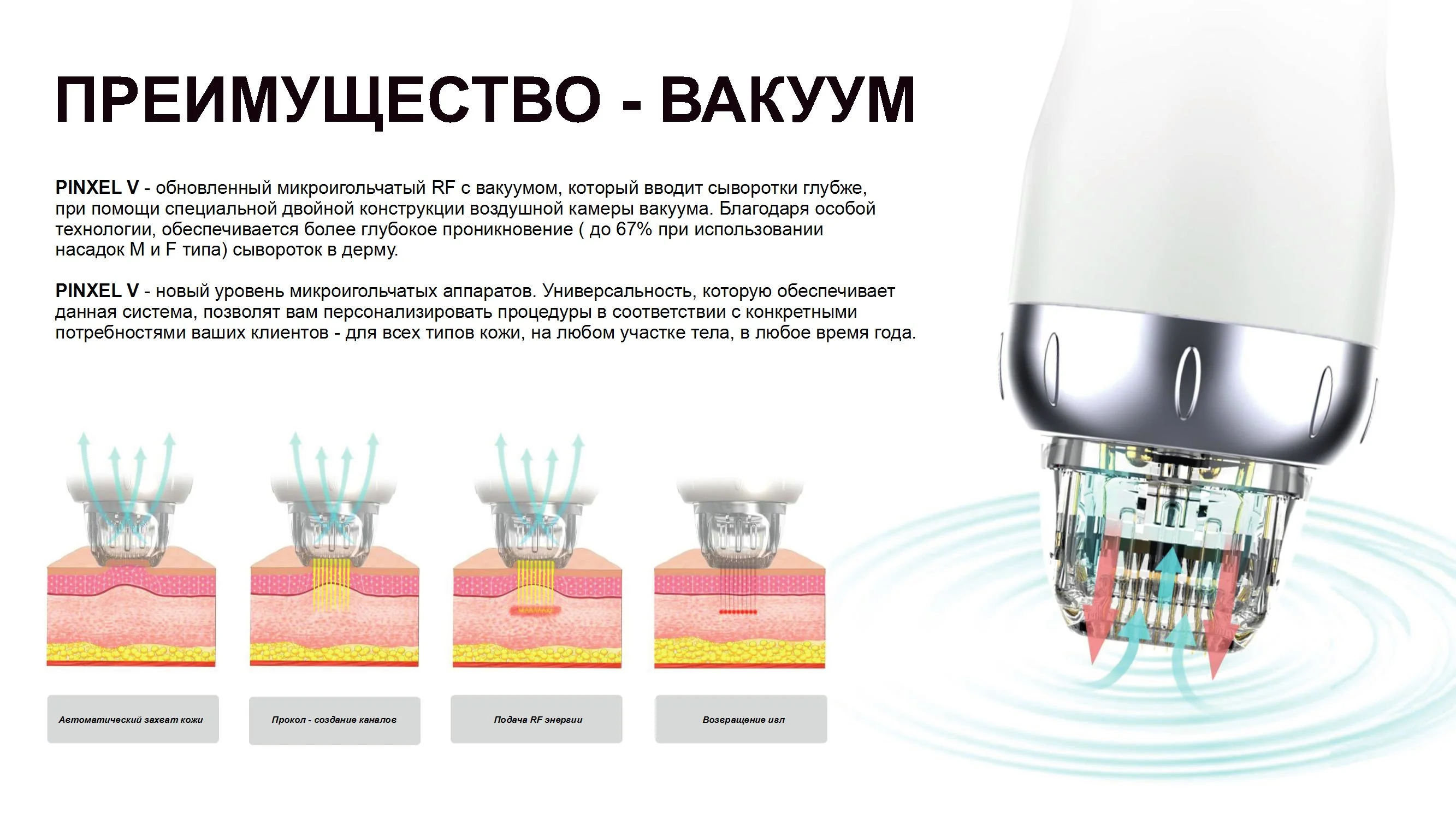 Преимущества вакуумной технологии